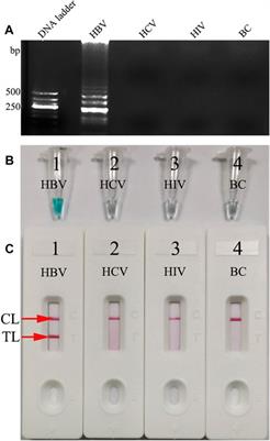 Nanoparticle-Based Lateral Flow Biosensors Integrated With Loop-Mediated Isothermal Amplification for the Rapid and Visual Diagnosis of Hepatitis B Virus in Clinical Application